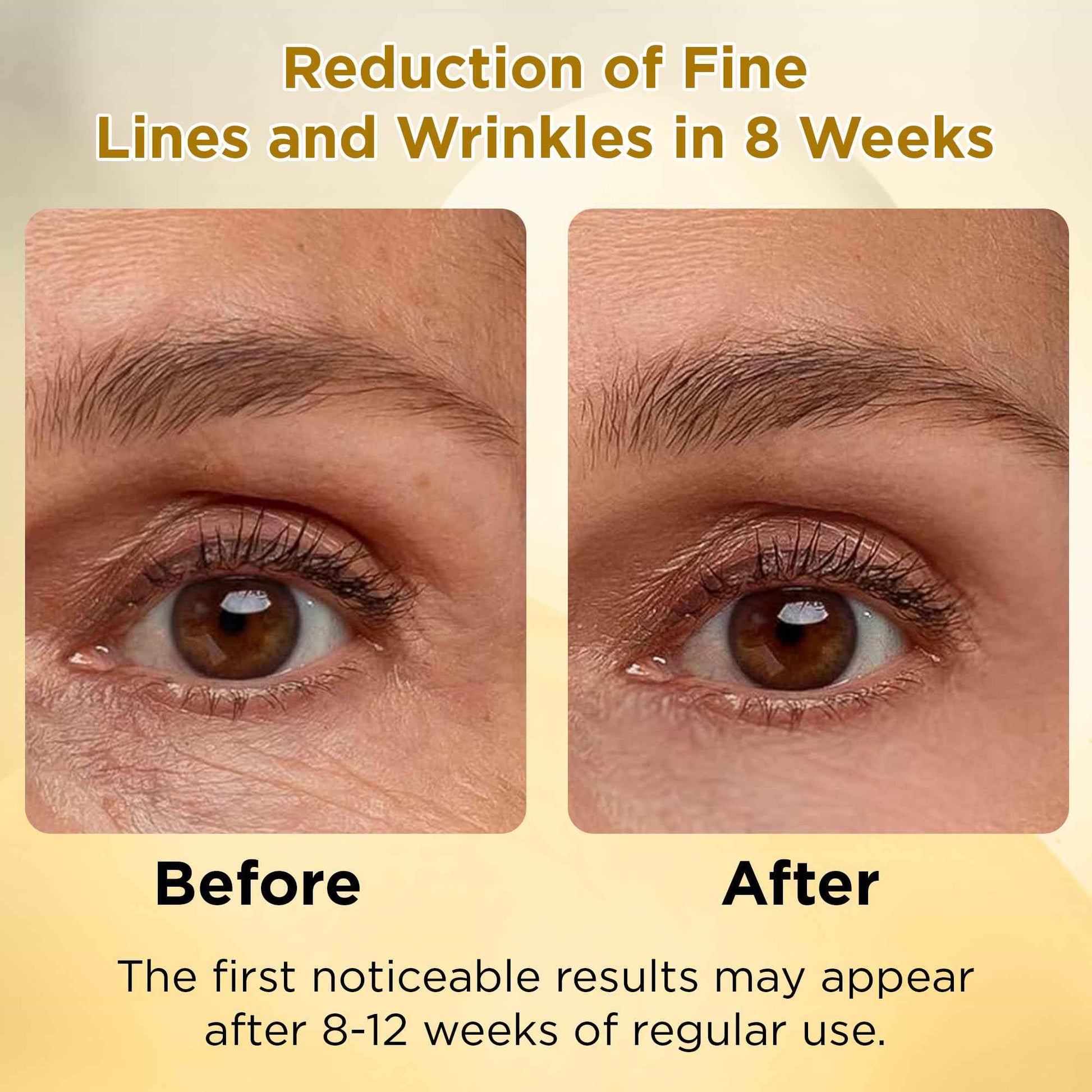 LADY NADA Retinol Eye Serum – Anti-Aging Night Treatment with Collagen, Vitamin E & Natural Extracts – Smooths Fine Lines, Deeply Hydrates, Long-Lasting Effect – For All Skin Types – 1.0 fl oz