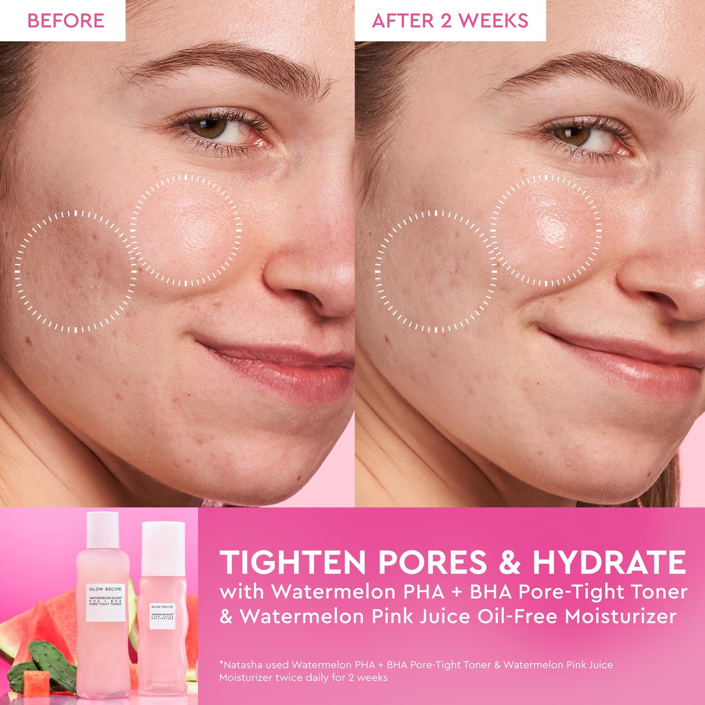 Glow Recipe Pink Juice Water Gel Moisturizer Travel Size, Korean Gel Moisturizer for Glass Skin, Oil-Free Hydrating Hyaluronic Acid Face Moisturizer for Oily Skin, Non-Comedogenic, Long-Lasting (25ml)