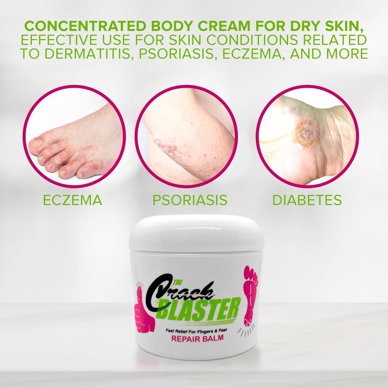 Crack Blaster Repair Balm - Lanolin Based Thick Moisturizing Balm for Dry Skin, Heel Pain, Plantar Fasciitis, Athletes Foot - 4 OZ Original Formula!