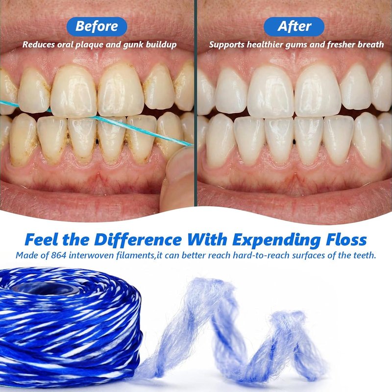 Expanding Woven Dental Floss - Waxed Mint Floss for Gentle Oral Care | 10 Spools (32.8 Yd Each)