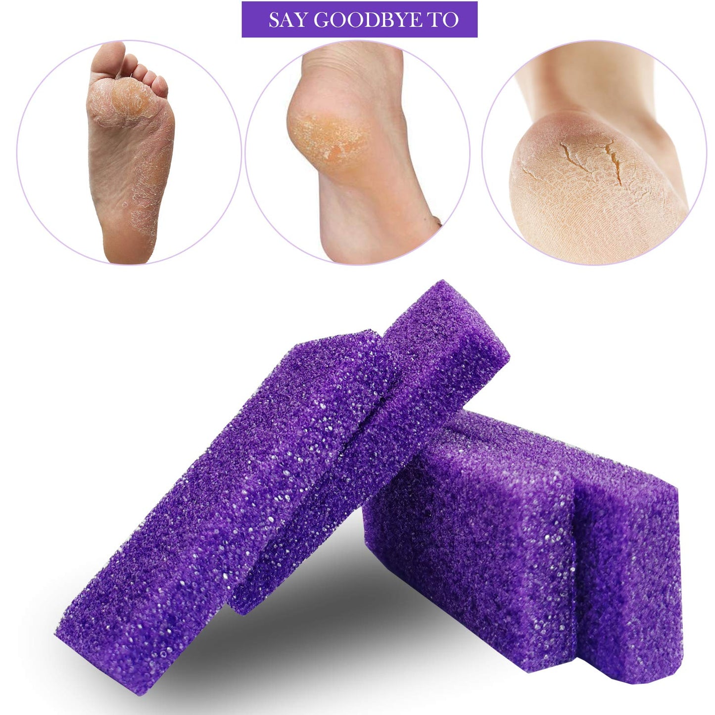 Tailpa 40 Pcs Pumice Stone for Feet, Foot Scrubber Sponge, Purple