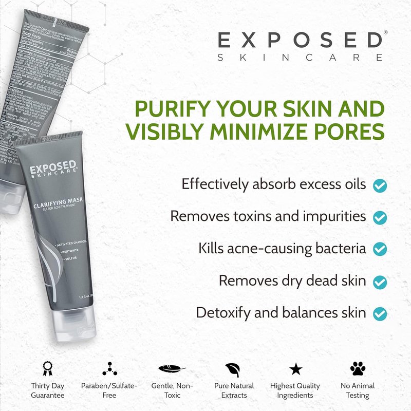 Acne Treatment Mask - 3% Sulfur & Activated Charcoal | Oil Control for Teen & Adult Acne