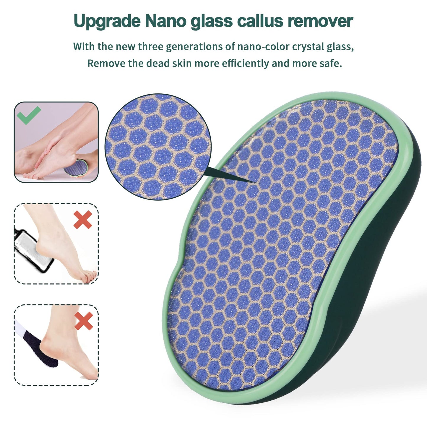 SIRALMNO Upgrade 2-in-1 Nano Glass Callus Remover,Foot Scraper which Used Wet and Dry Callus Removal,Foot Rasp for Hard&Dead Skin Foot Care,Safe & Portable Foot File