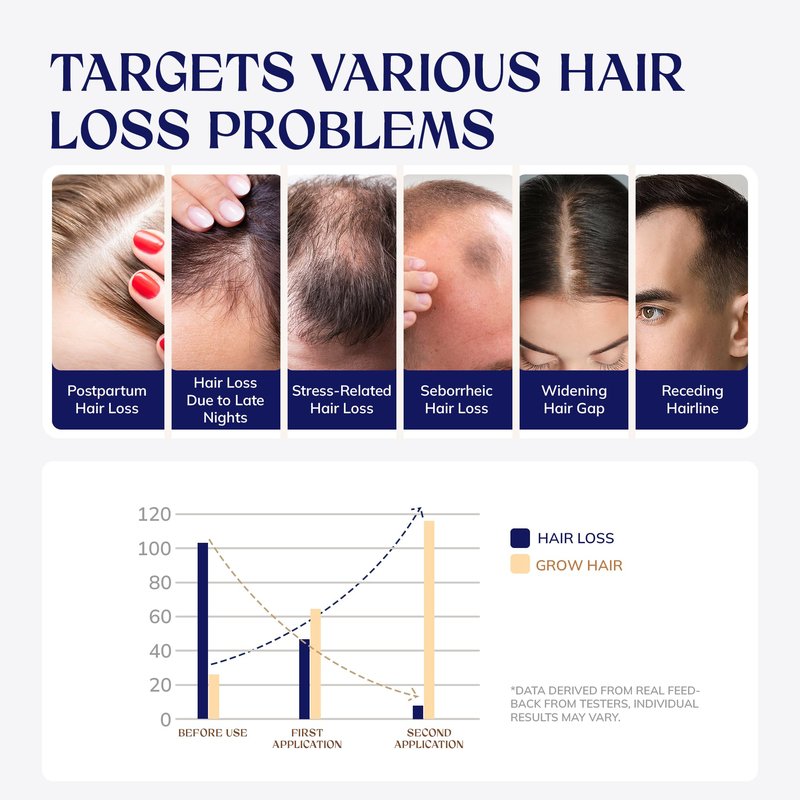 RootStim Hair Growth Serum for Men & Women, Hair Growth Spray, Rice Water & Biotin & Caffeine - Hair Oils for Hair Growth -Longer, Fuller Hair