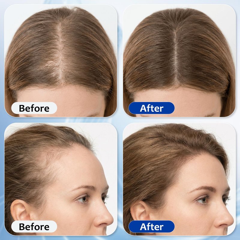 Hair Growth Serum Roll On with 3% Rosemary,3% Batana Oil,2% Pea Extract,2% Ginger Root Oil,Stronger Root,stimulate follicle,Hair Thicker,Hair Loss Treatment,Hair Growth Serum(30ML/1.01FL.OZ)