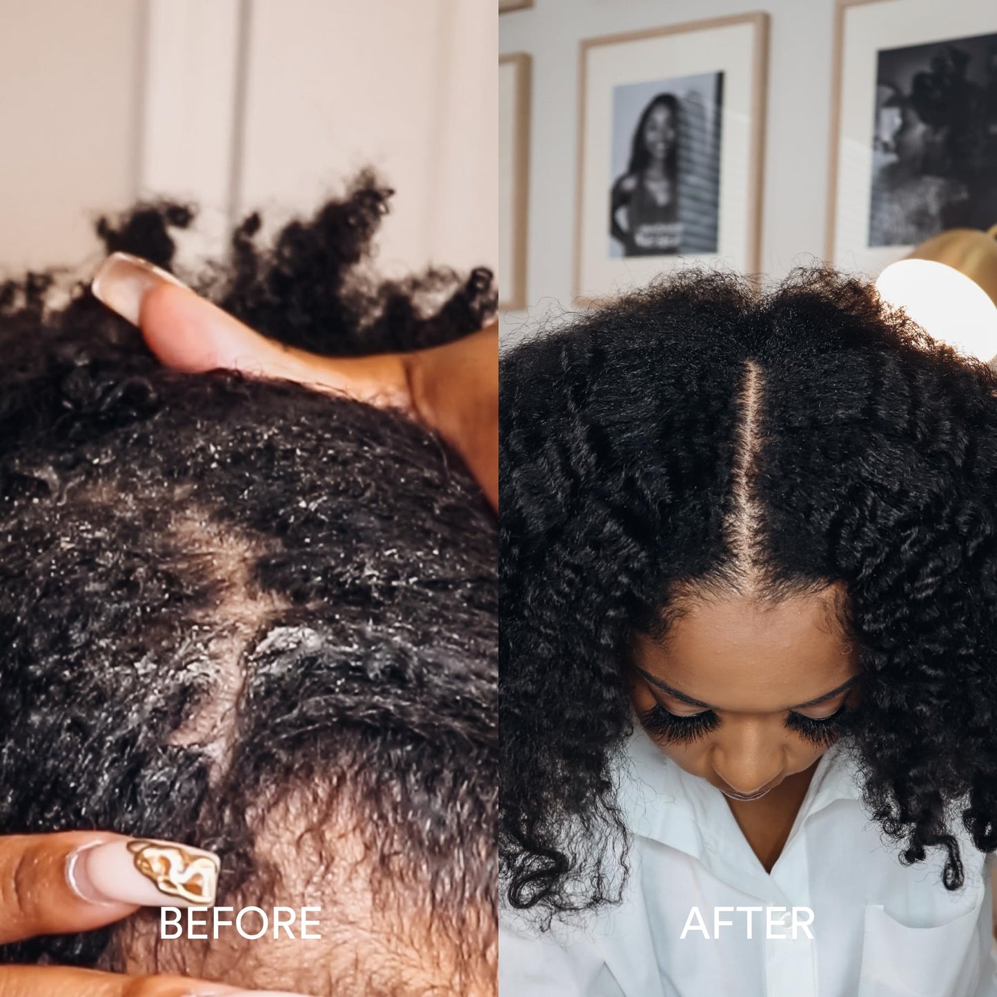 Dermazen Nourishing Conditioner for Dry, Flaky Scalp | Steroid-Free & Malassezia-Safe | Hydrates, Smooths & Reduces Visible Flaking | MCT & Rosemary | Pairs Shampoo | 8 fl oz