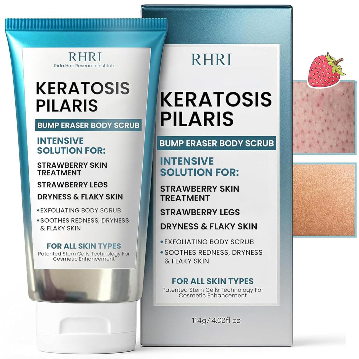 KP Bump Eraser Body Scrub with 10% AHA | Keratosis Pilaris Treatment | Bump Eraser Body Scrub | Clears Strawberry Legs | Soothes Redness, Dryness & Flaky Skin
