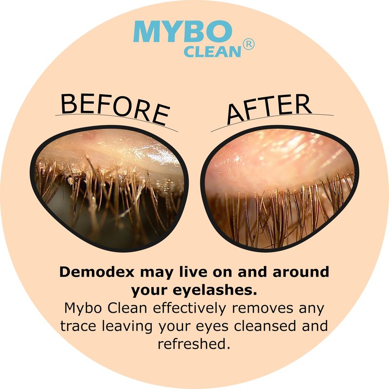 Myboclean Hydrating Lids and Lash Cleansing Gel, Manuka Honey UMF 16+, Aloe Vera, Coconut Oil, Dead Sea Salt, 1.69 Fl Oz