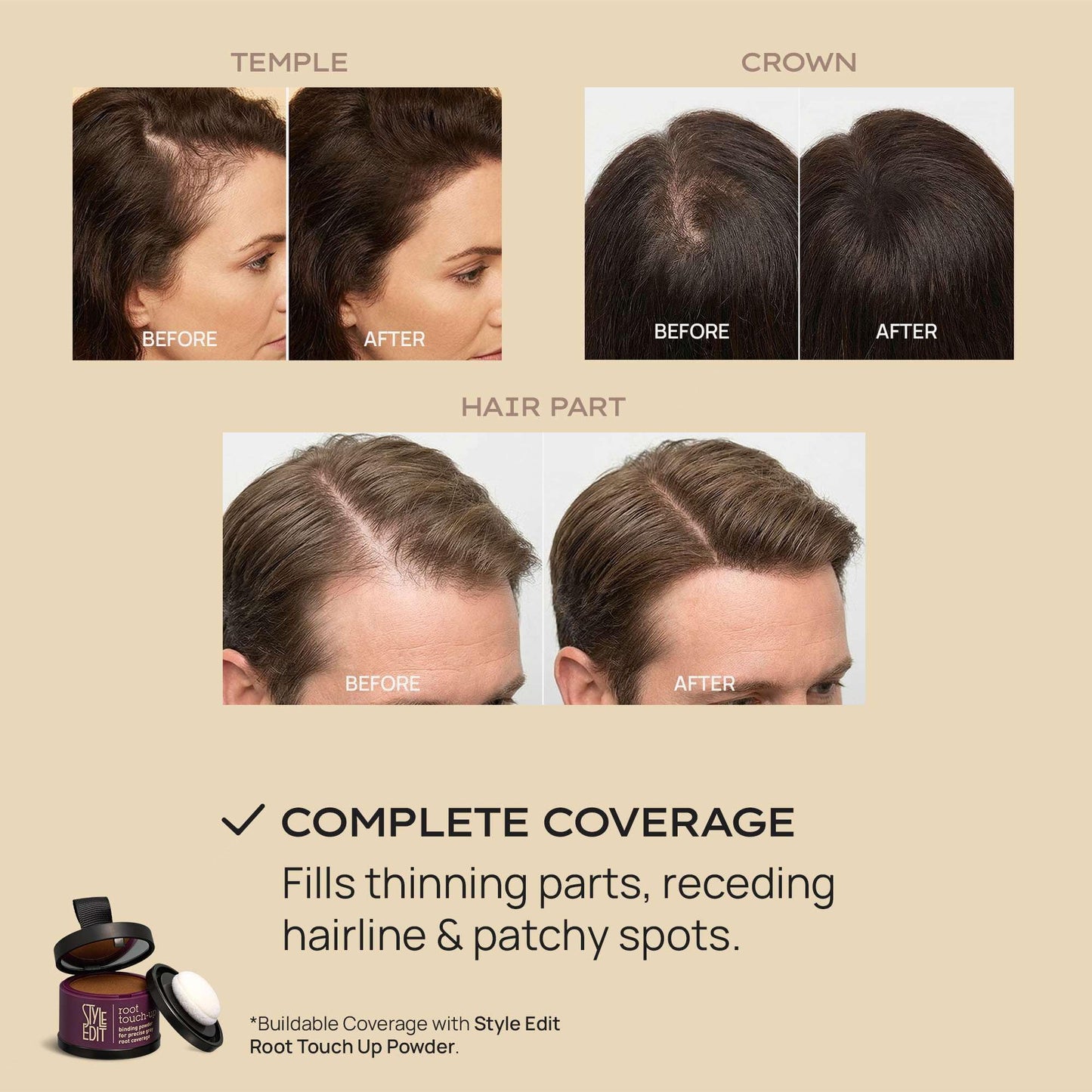 Style Edit Hair Building Fibers for Thinning Hair | Conceals Receding Hairlines, Fine Hair & Bald Spots | 100% Plant-Based Hair Thickening Powder for Men & Women, 0.88oz