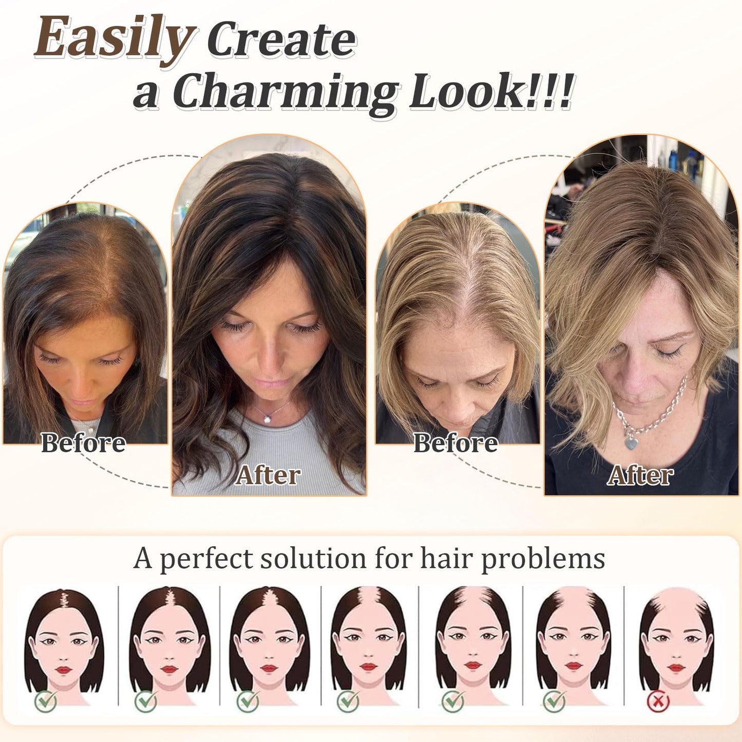 Lommel Short Wavy Hair Toppers for Women 12 Inch Hair Topper with Thinning Hairs Natural-Looking Wiglett Lightweight & Add Volume Hairpiece for White Roots Cover for Daily(Dark Brown)