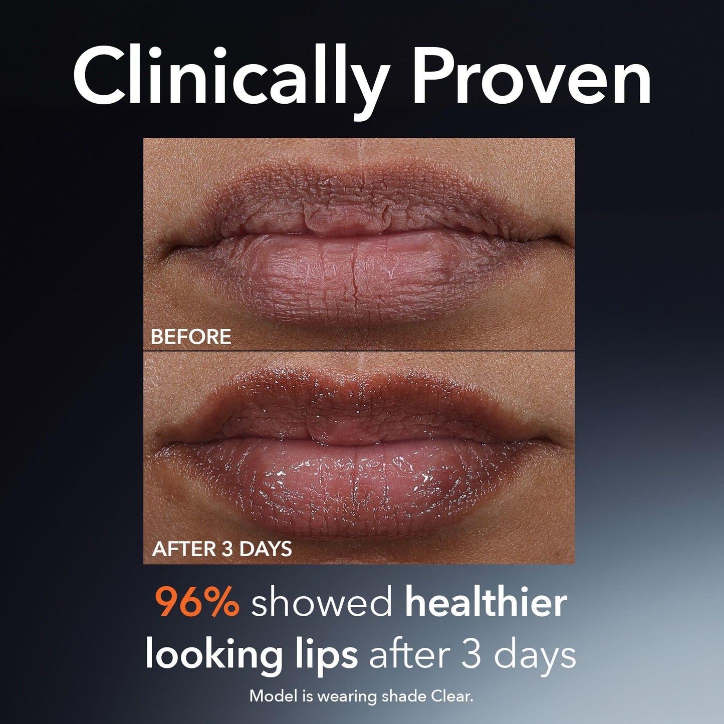 Dr Dennis Gross DermInfusions Plump + Repair Tinted Lip Treatment, Beige - Visibly Plumps & Defines Lips with Hyaluronic Acid & Peptides - Repairs Moisture Barrier - 4 mL