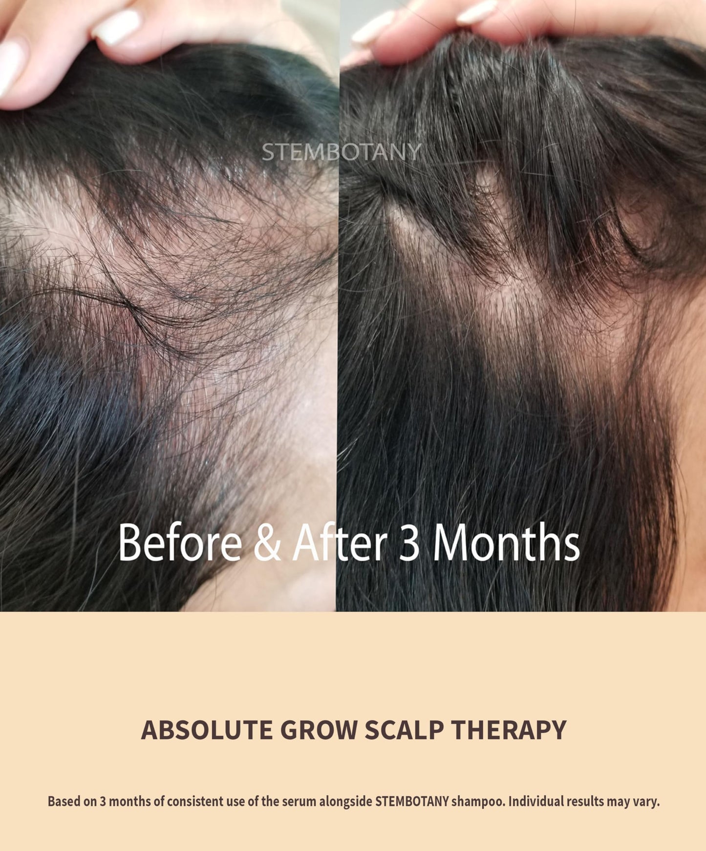 BIOCELLMED Copper Peptide Absolute GROW® Scalp Serum with Copper Peptides and Plant Stem Cells for Hair, 1.05 oz