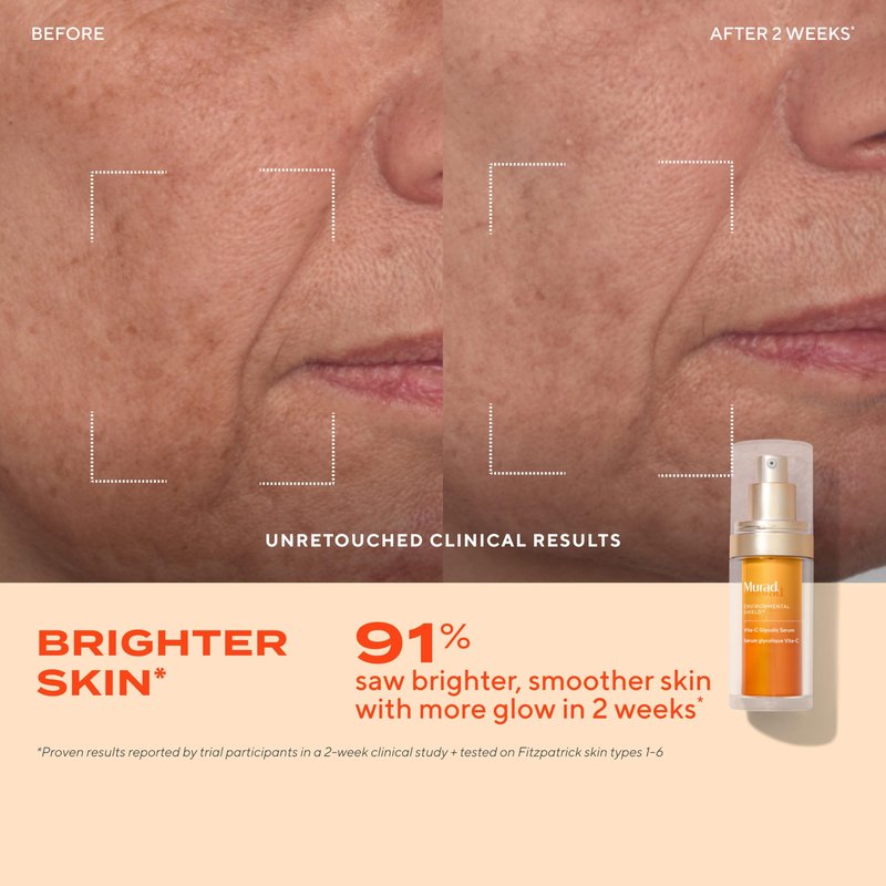Murad Revive + Repair w/Glow Up Ingredients - 3-Piece Set ($135 Value) - Regimen for Total Skin Health - AHA/BHA Cleanser 5.0Fl Oz, Glycolic Serum 1.0Fl Oz, Cellular Hydration Cream 0.25Fl Oz