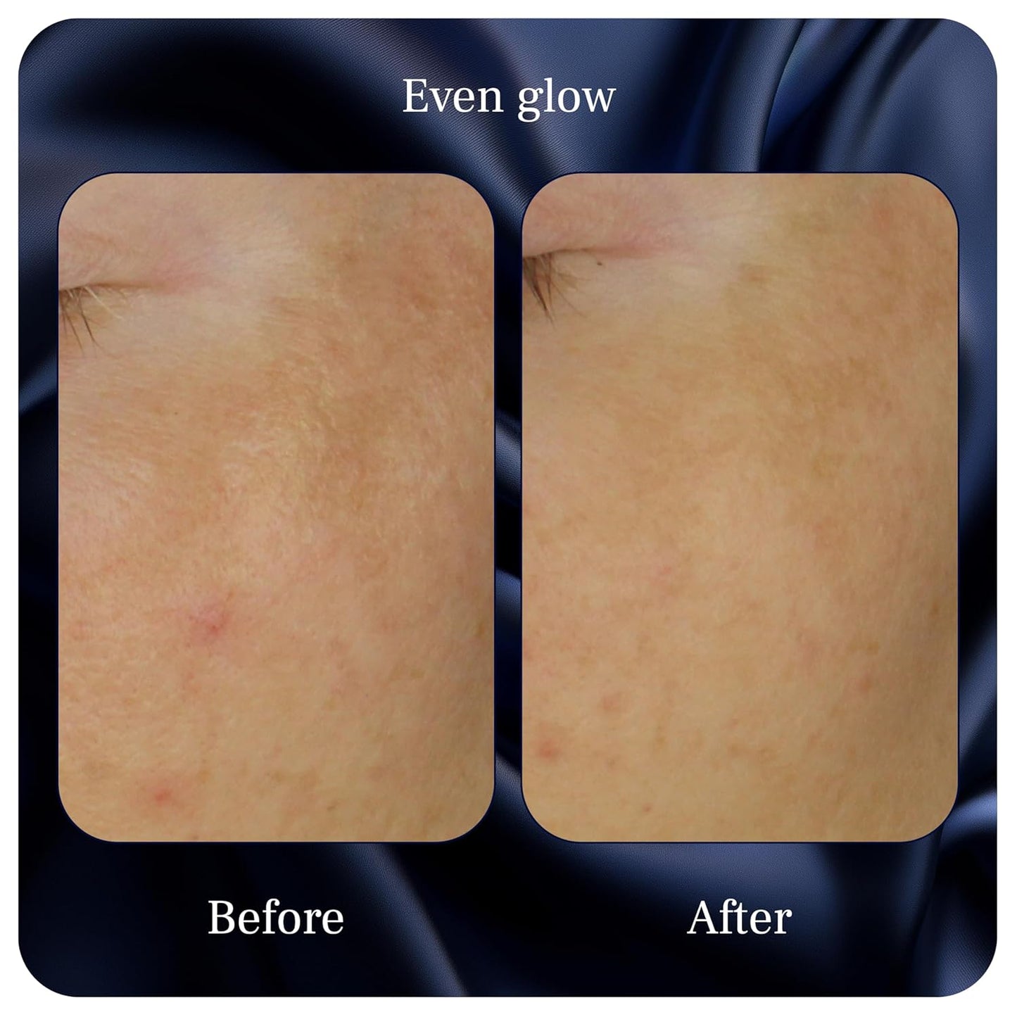 Organic Vitamin C Serum - Dark Spot Corrector with Kakadu Plum | 1 Fl Oz for Face & Body