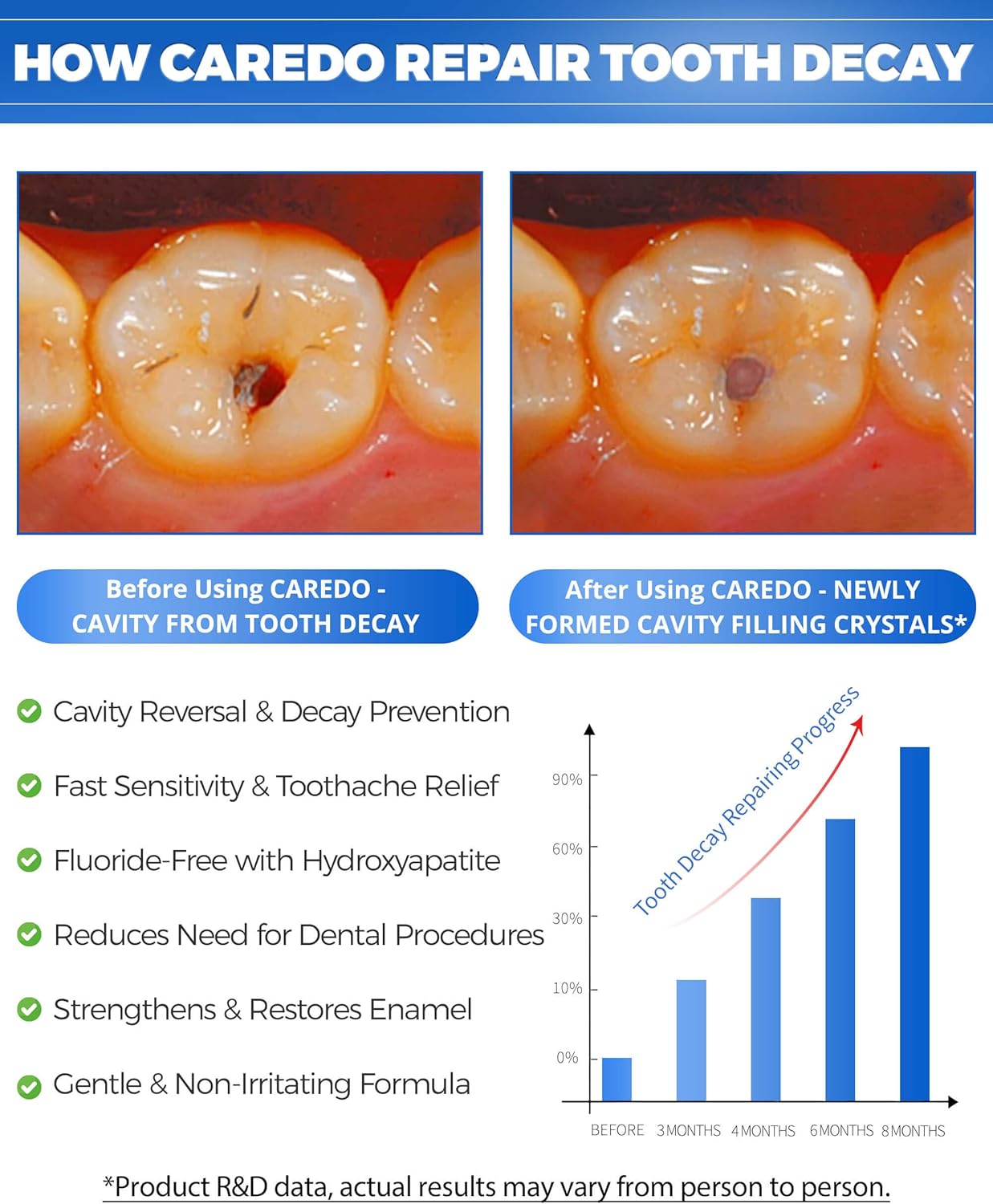 Cavity Repair Toothpaste - Remineralizing Hydroxyapatite Formula for Tooth Decay | 100g, Grey White