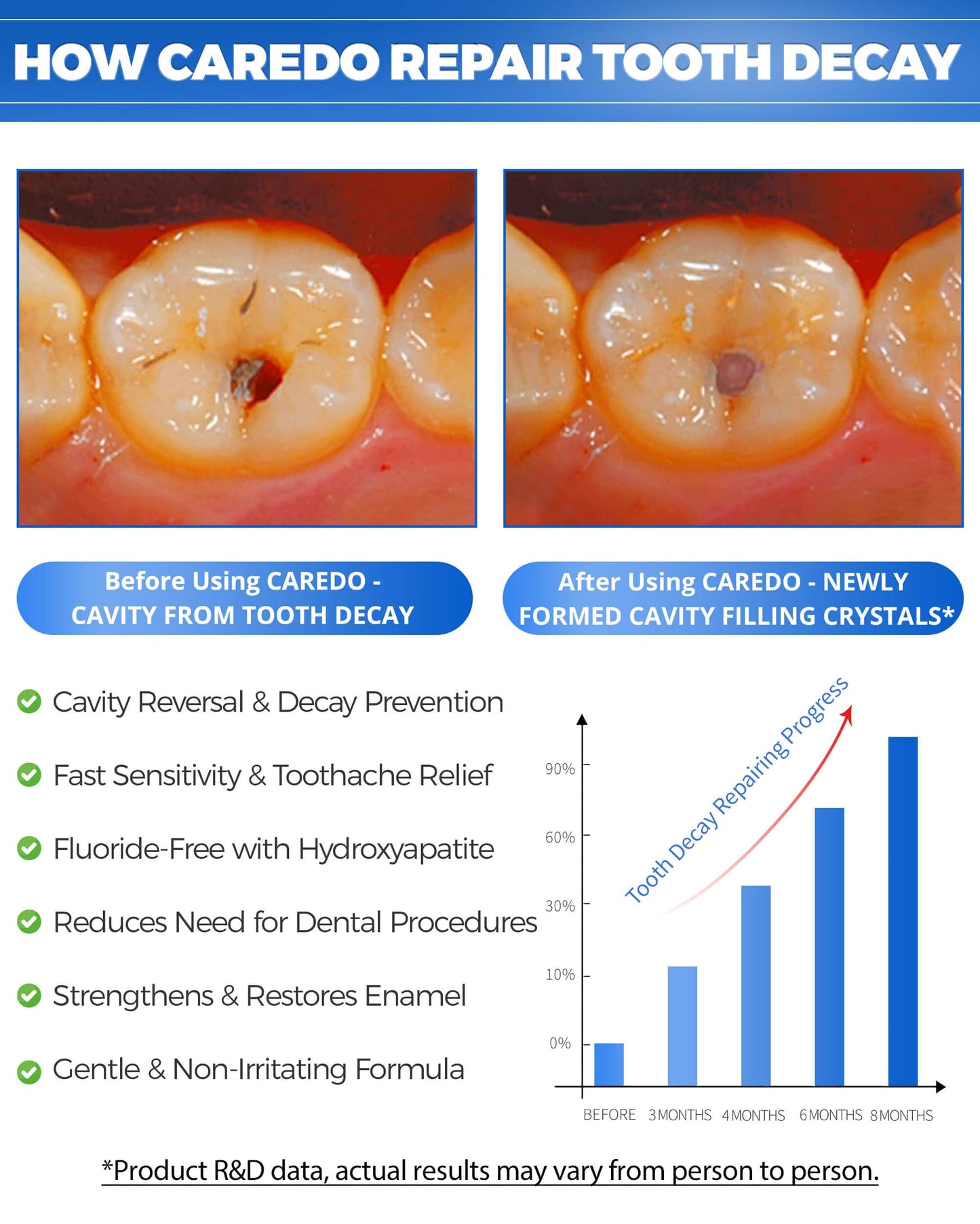 CAREDO Cavity Reversal Hydroxyapatite Toothpaste for Adults, Cavity Tooth Filler as Home Cavity Repair, Fluoride Free Reverse Cavities Treatment for Tooth Decay Repair, Remineralizing Repair 3.52OZ