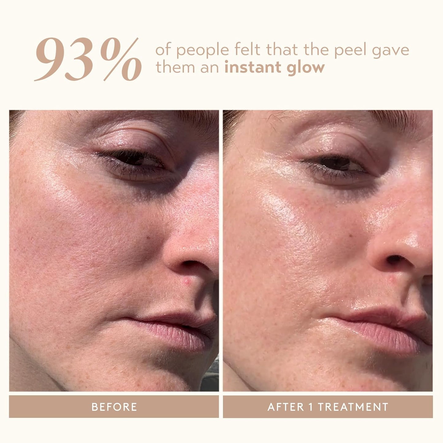 SHANI DARDEN SKIN CARE Triple Acid Peel - 2-Step Exfoliating Face Treatment with Mandelic & Glycolic Acids | 8 Peels + Mask & Brush