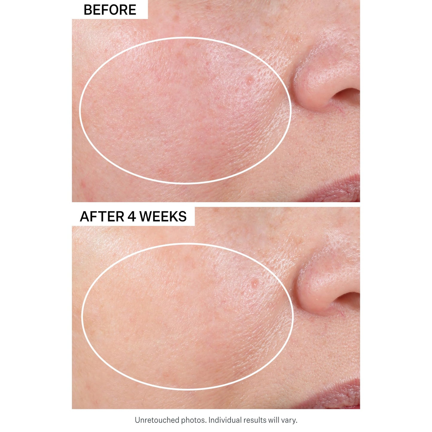 StriVectin Advanced Retinol Discovery Kit with Retinol Night Moisturizer, 1 oz, Multi Correct Eye Cream 0.5 oz, 2 Piece Kit for Wrinkles and Fine Lines
