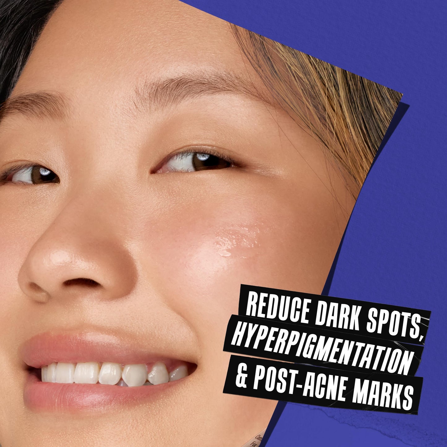 Kiehl's Clearly Corrective Dark Spot Serum, Corrective Skincare Solution Clinically Proven to Even Skin Tone, Plump Skin, Reduce Hyperpigmentation & Boost Radiance, Use as Spot Treatment or Serum