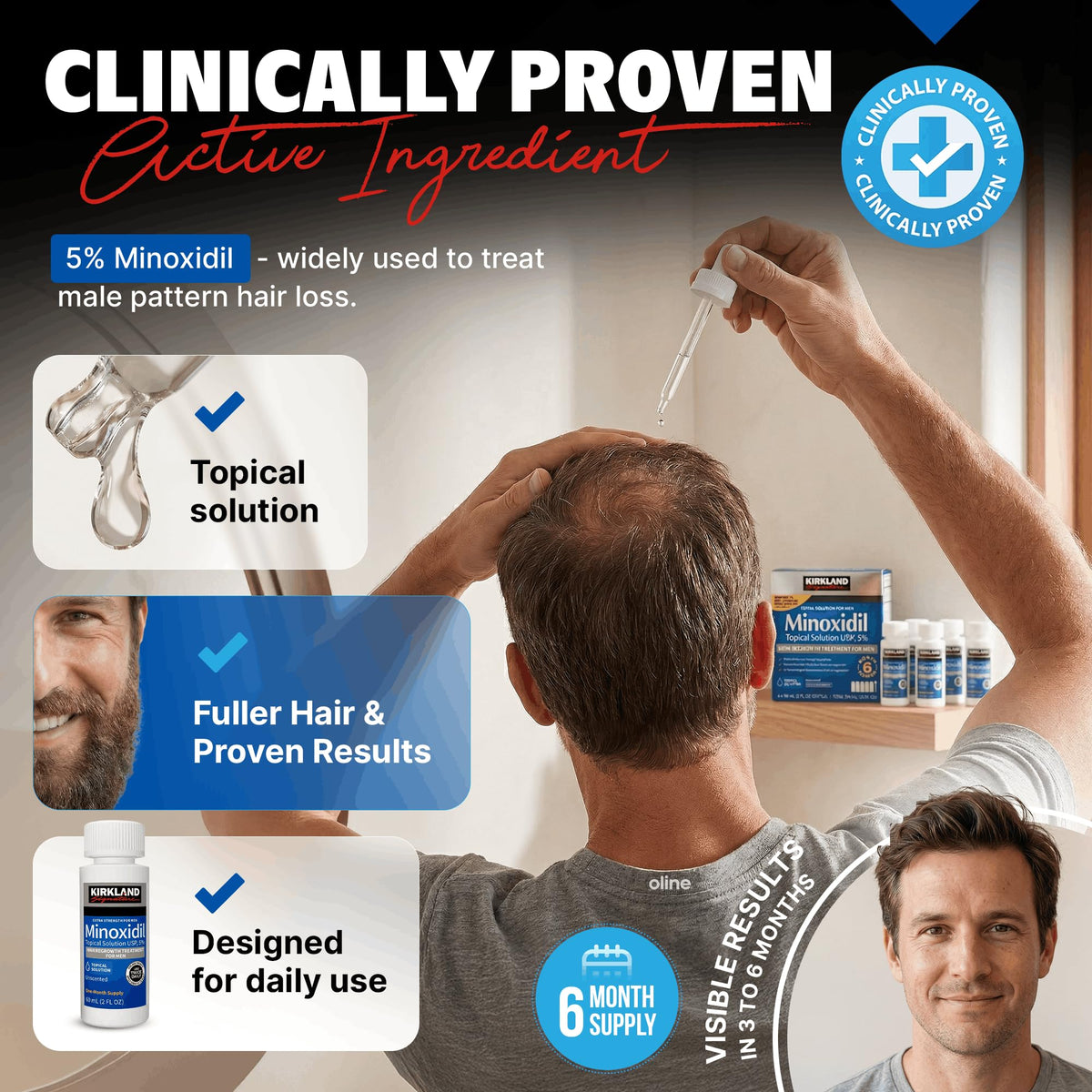 Kirkland Signature Minoxidil Topical Solution USP 5%, Extra Strength Hair Regrowth Treatment for Men, 6 Months Supply