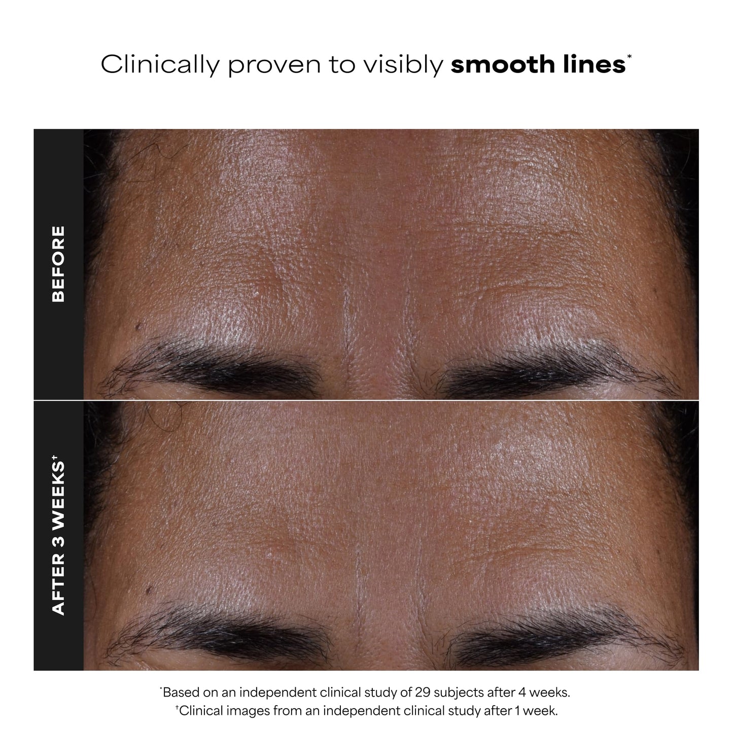 Paula's Choice SKIN PERFECTING 2% BHA Salicylic Acid Exfoliating Pads,10 Ct
