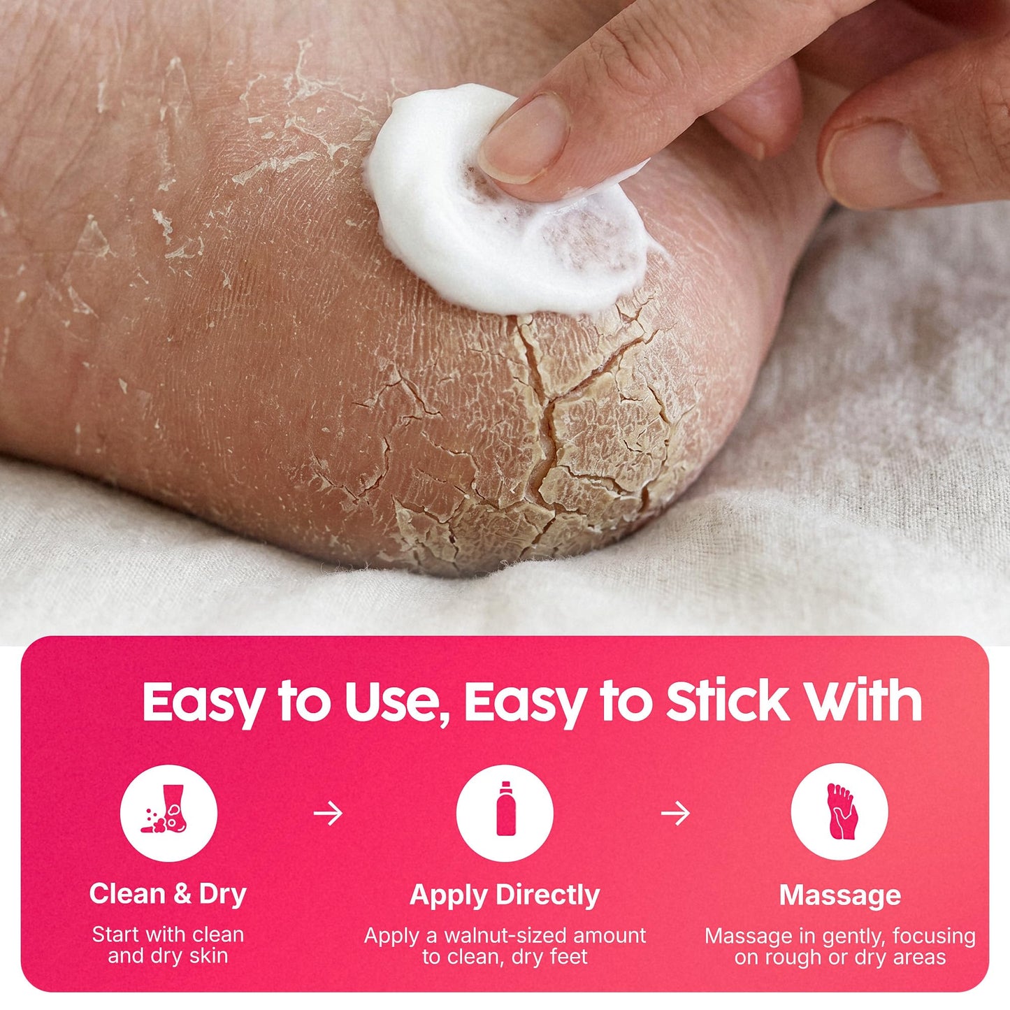 FOOTLOGIX Rough Skin Formula Mousse with Spiraleen® 4.23 oz | Urea Foot Mousse with Tea Tree Oil & Aloe Vera | Lightweight Moisturizer for Dry, Rough Skin | Dermal Infusion Technology | Men & Women