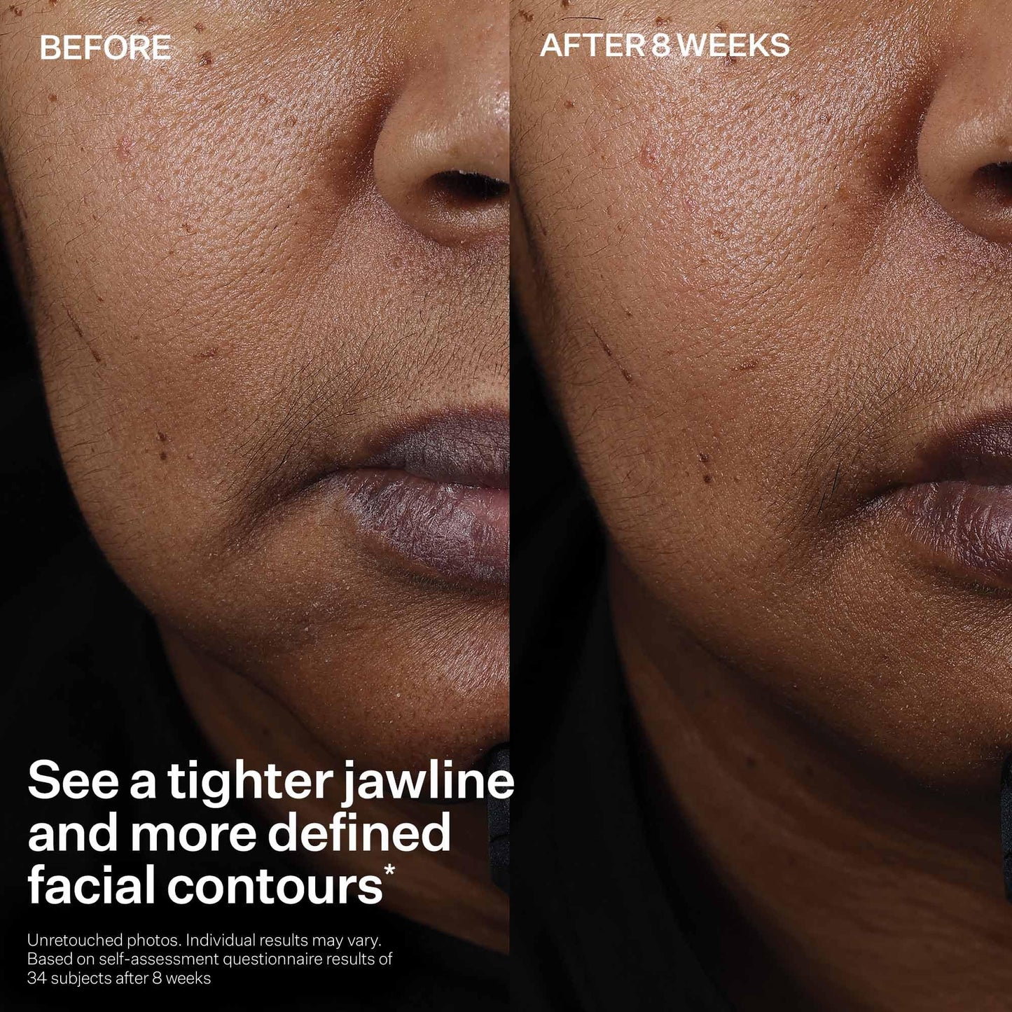 StriVectin Tighten and Lift Peptight Face Lift Serum with Tightening and Brightening Peptides for Wrinkles, Under Eye Bags and Puffiness, 30 mL