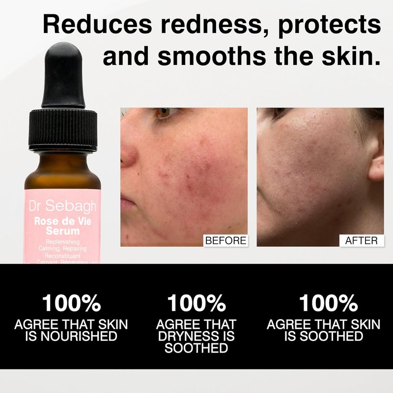 Dr Sebagh Rose de Vie Serum - Nourishing Anti-Aging Formula for Dry, Mature Skin - 0.17 fl oz | Soothes Redness & Irritation
