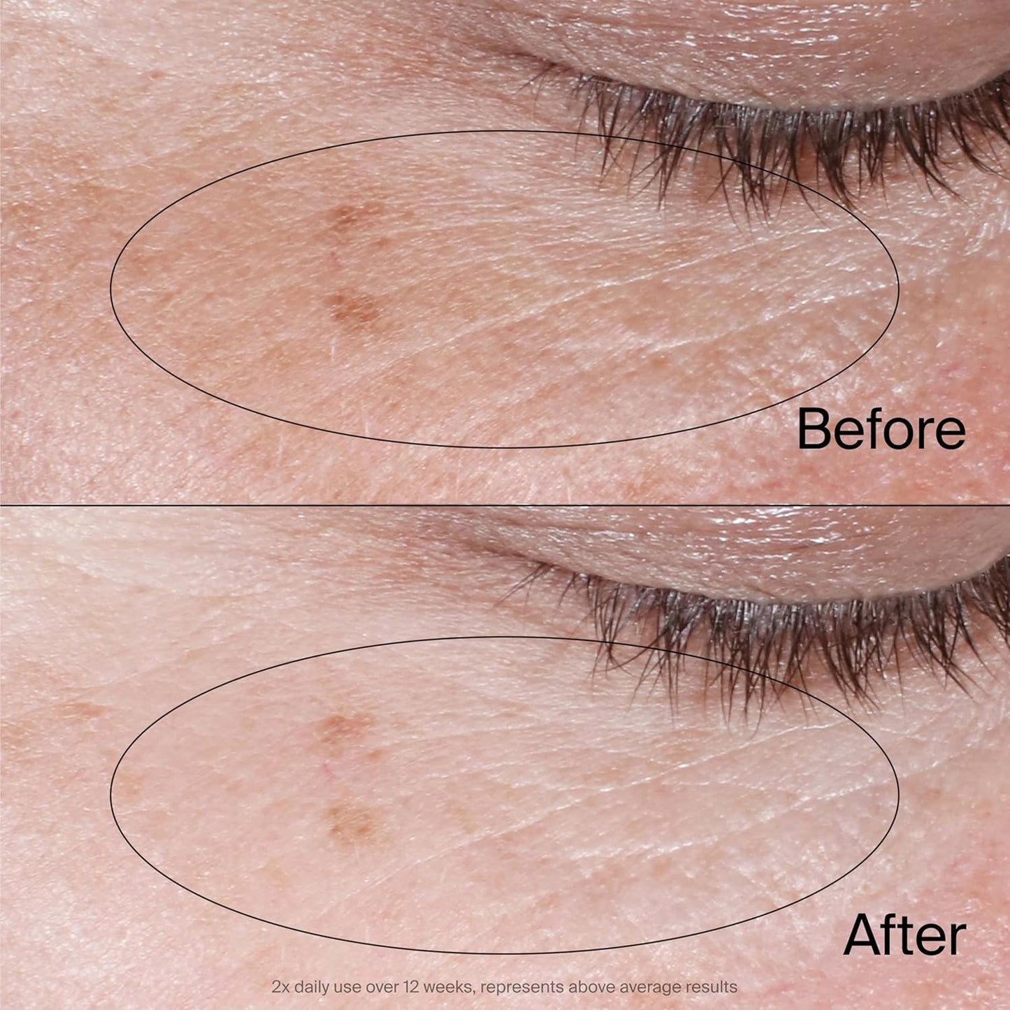 Neutrogena Collagen Eye Cream - Revive Dark Circles & Puffiness | Fragrance-Free, 0.5 oz