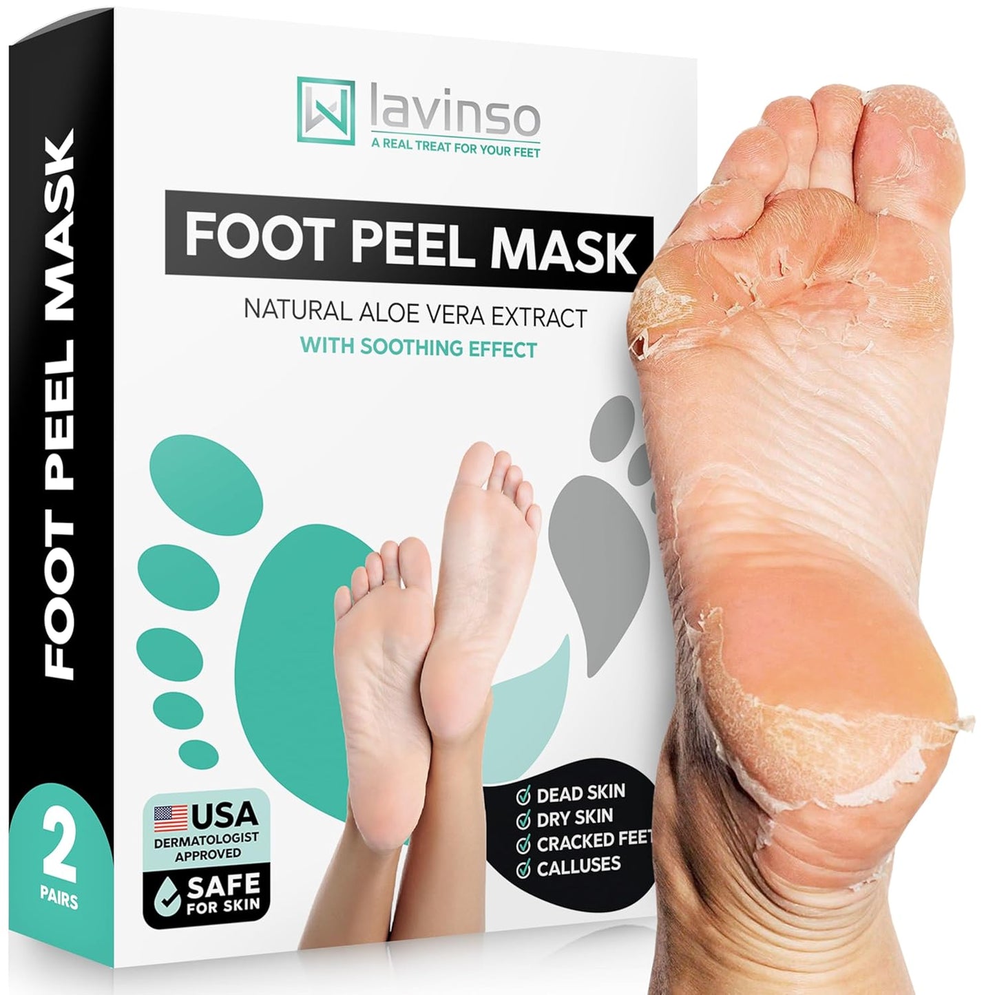 Lavinso Foot Peel Mask - Exfoliating Treatment for Dry, Cracked Feet | 2-Pack Peeling Mask for Soft, Smooth Skin