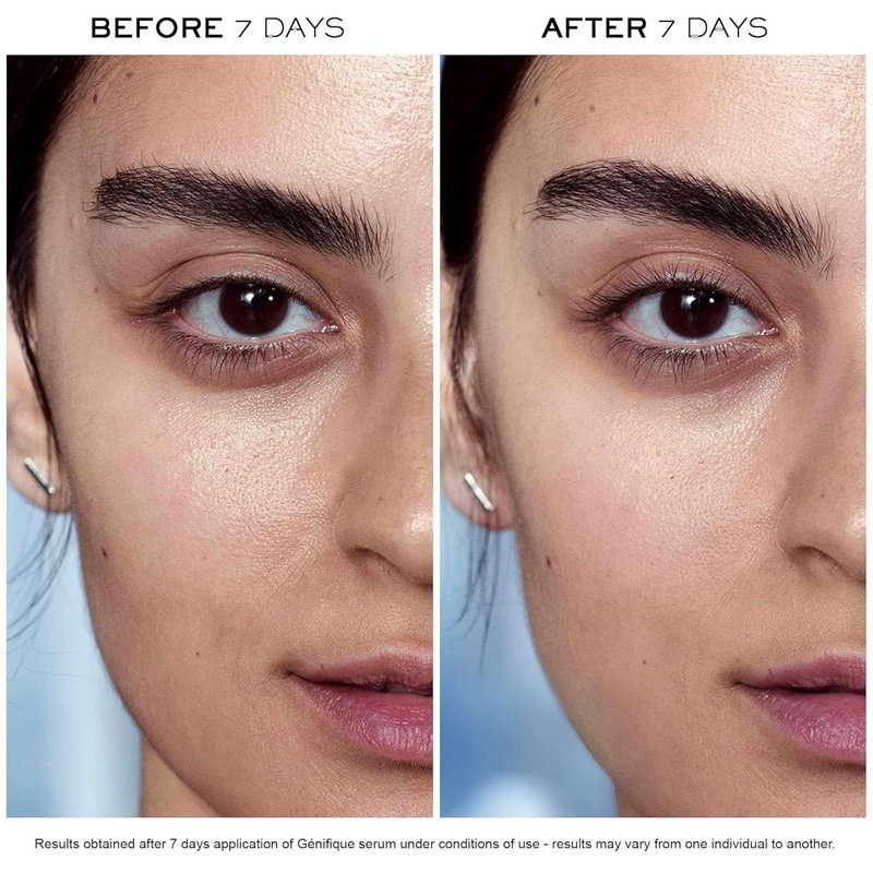 Lancôme Advanced Génifique Face Serum - Anti-Aging Radiance Booster with Bifidus Prebiotic & Vitamin Cg | Hydrating & Plumping 1 oz