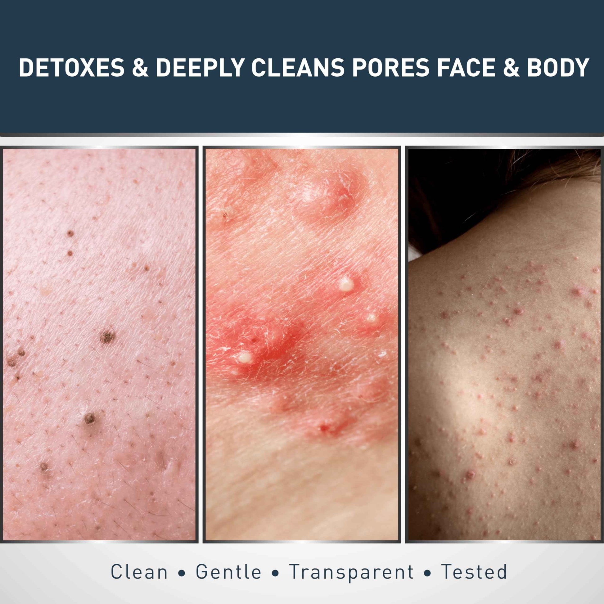 Jericho Dead Sea Mud Soap Bar, Natural Face & Body Detox with Exfoliating Dead Sea Minerals & Soothing Witch Hazel. 4.4 Oz /125g (Pack of 6)