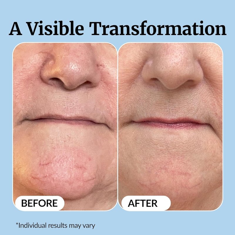 Vibriance Super C Serum - All-in-One Anti-Aging Vitamin Formula for Mature Skin | Hydrates, Firms & Smooths, 1 fl oz