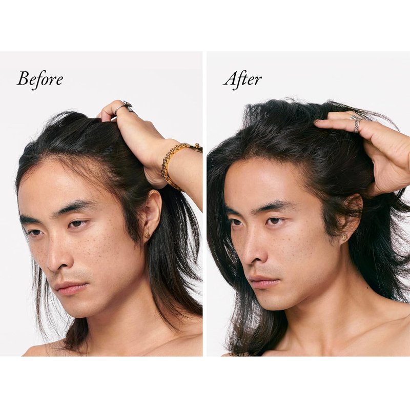 Oribe Serene Scalp Densifying Treatment Spray for Thinning Hair - Volume & Hydration with Capixyl™ | 4.2 oz