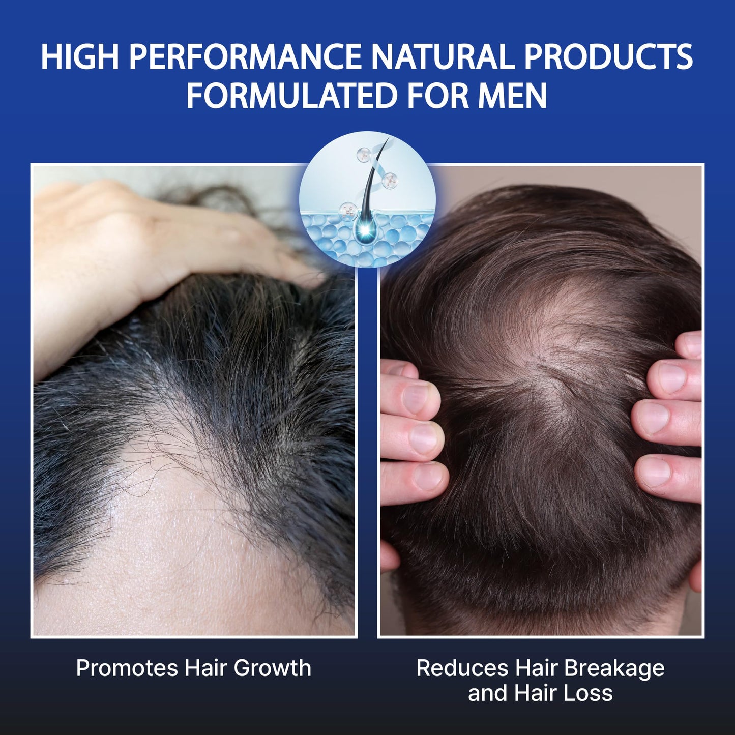 RED Pro GROOMANE Men Biotin Shampoo for Thinning Hair, Clarifying Anti-Dandruff Scalp Care with Caffeine, Menthol & Tea Tree, Strengthens Roots, Promotes Thicker-Looking Hair, Sulfate-Free