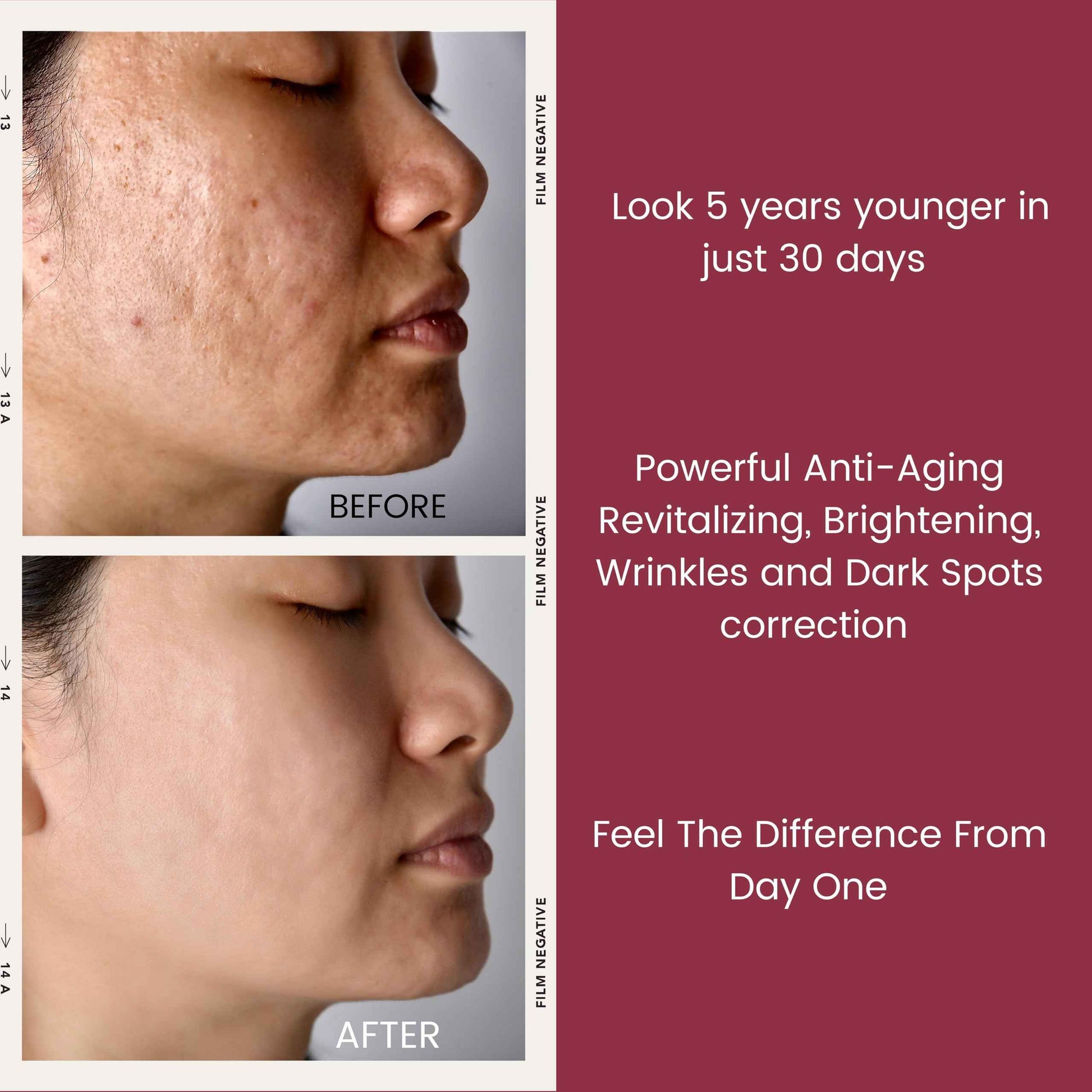 TURBINNE Pure 2.5% Retinol Serum Capsules. Look 5 Years Younger In Just 30 Days. Powerful Anti -Aging, Deep Hydration, Brightening, Reduce Wrinkles, Acne Scars, Dark Spots. Complete Skincare Capsules