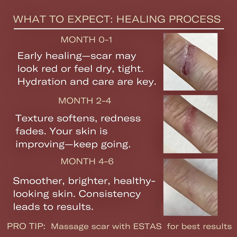 ESTAS Beauty Scar Cream On The Go -Daily Vitamin E & C with Silicone, For Old & New Scars on Face & Body, Ideal For Surgical, Burn, C-Section & Acne Scars, Vegan + Cruelty Free, (0.17oz pack of 3)