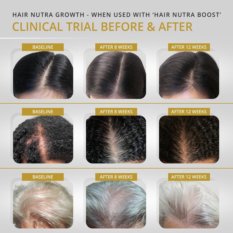 VITAMINS REVIVE Hair Growth Vitamins Supplement for Women - Vegan Formula Clinically Tested in USA - Hair Loss Capsules Thinning Complex & Regrowth Treatment - 1 Month Supply