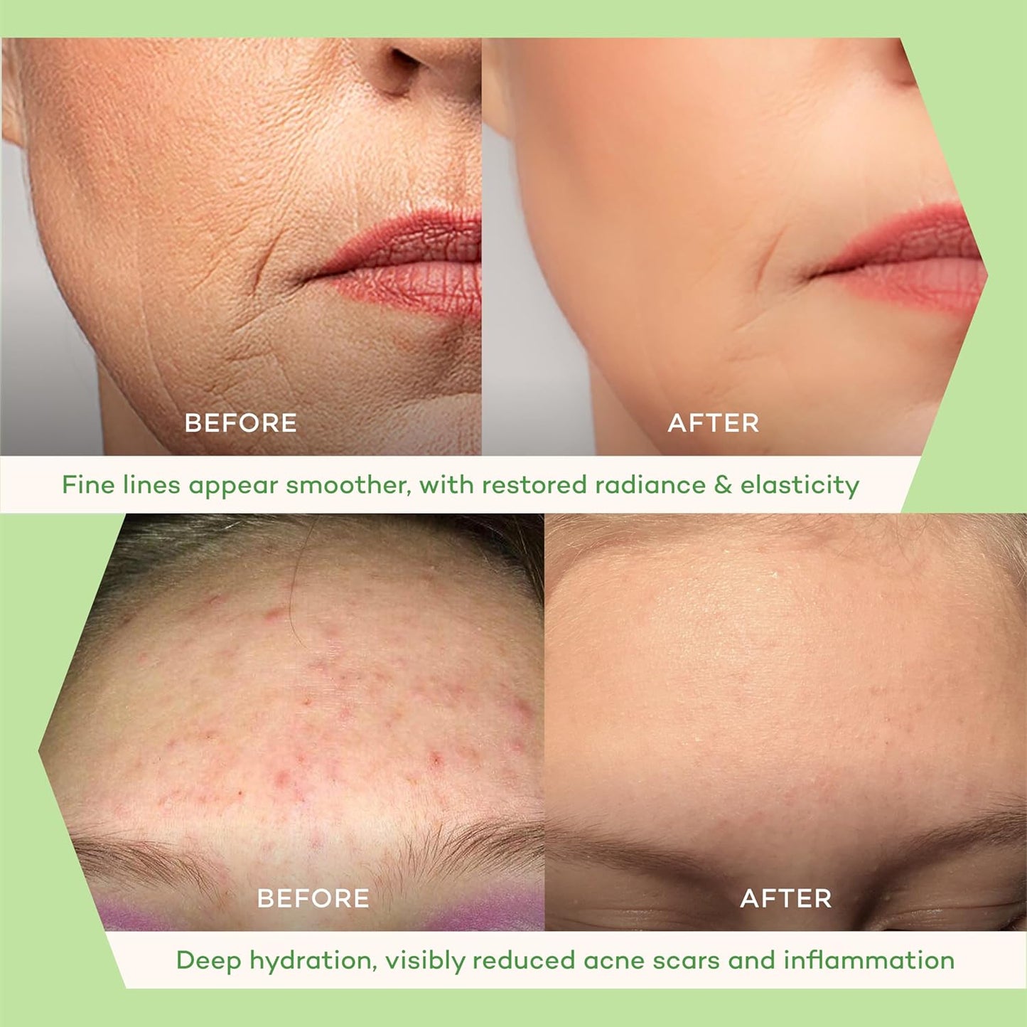 Eternity Facial Serum - Oil-Based Vitamin C Alternative for Women | Non-Greasy with Squalane, Sea Buckthorn & Nordic Microbes - 20ml