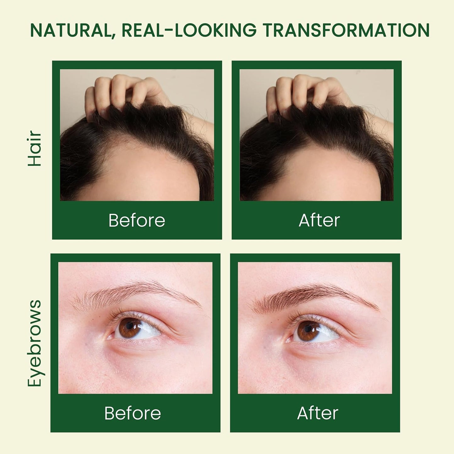 Pure Castor Oil - Cold Pressed 100% Natural Oil for Hair Growth, Skin & Nails | 10oz with Dual Mascara & Dropper