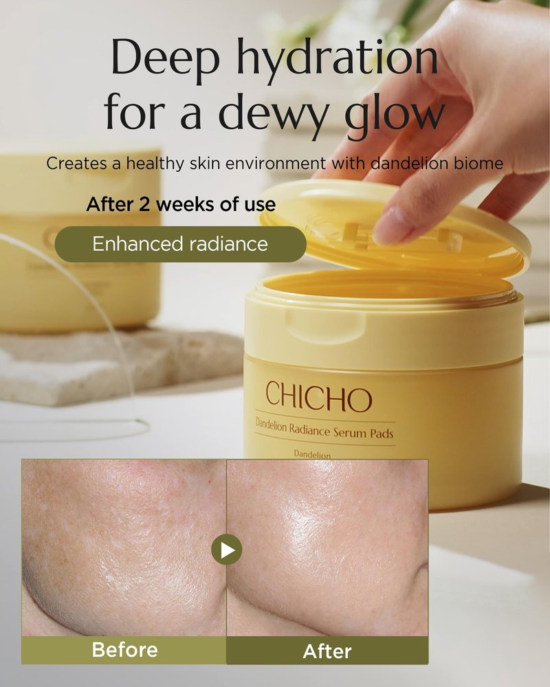 CHICHO Dandelion Radiance Serum Pads (90 Pads) – Jumbo 8cm Quick Mask Toner Pads – 80.2% Dandelion Biome + Lotus, Vegan pH 5.2, Sensitive Skin