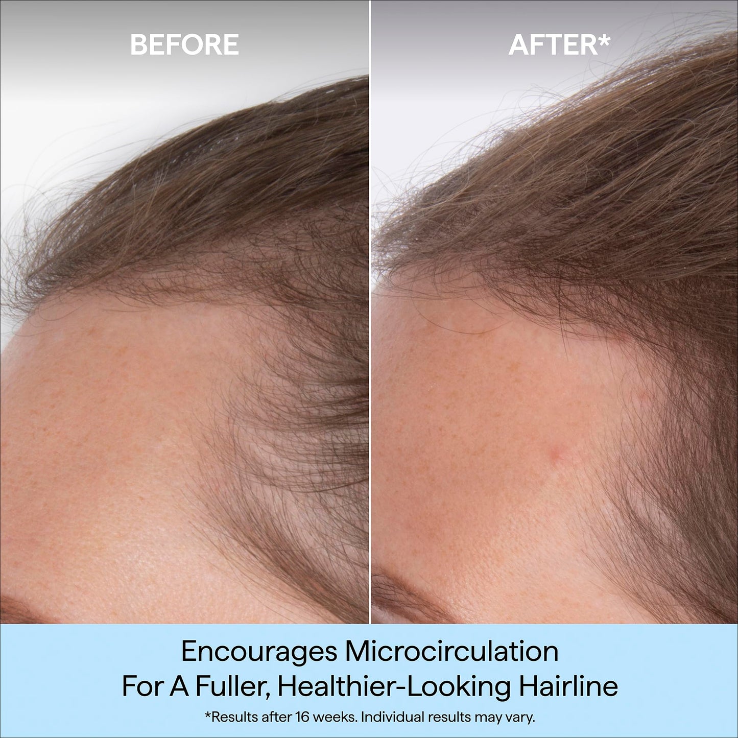 Briogeo Destined for Density Caffeine + Biotin Peptide Density Serum | Increases Hair Thickness & Volume for Fine or Thinning Hair | Fast-Absorbing & Non-Greasy | Fragrance-Free | Vegan & Cruelty-Free