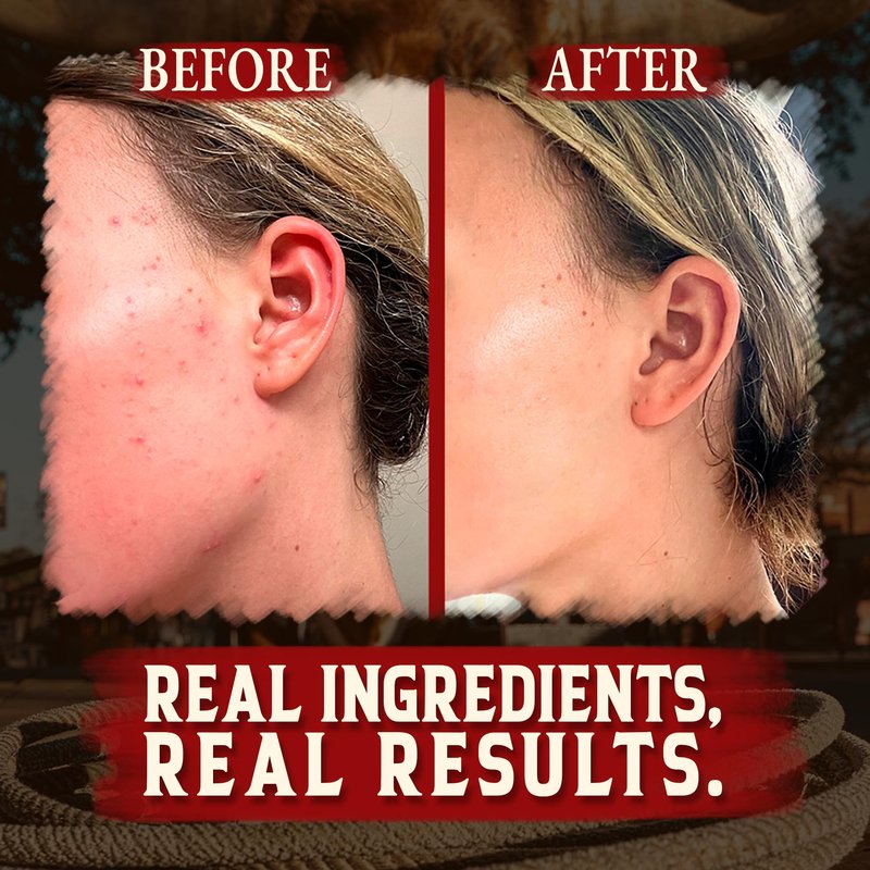 Organic Beef Tallow for Skin - 4 OZ (Unscented) — US-Made Grass Fed Beef Tallow for Face + Body — Whipped Tallow and Honey Balm Moisturizer for Dry and Sensitive Skin, Eczema, Rosacea (No Additives)