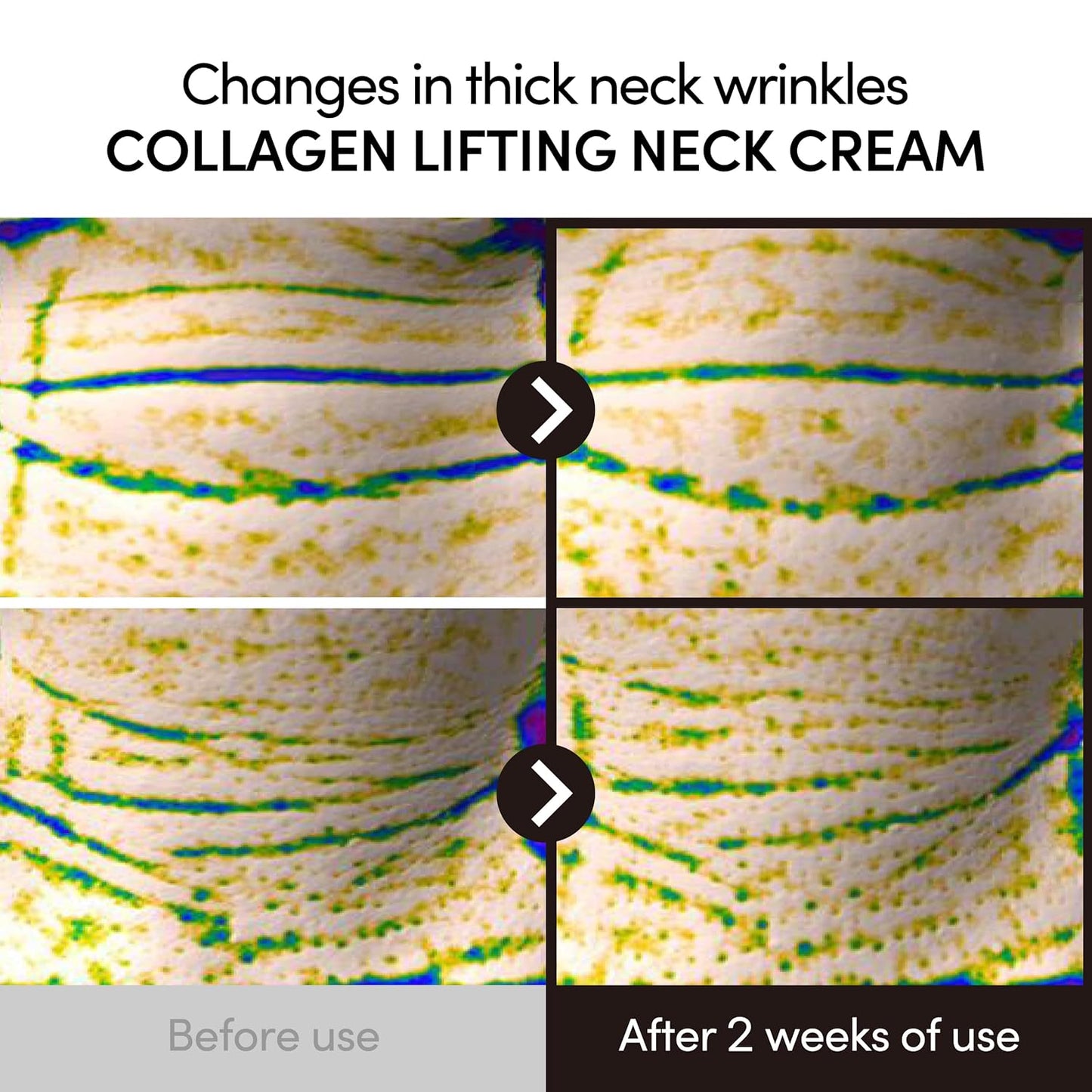 Collagen Lifting Neck Cream - Korean Skincare with Massage Roller for Jawline & Face | 1.69 Fl Oz