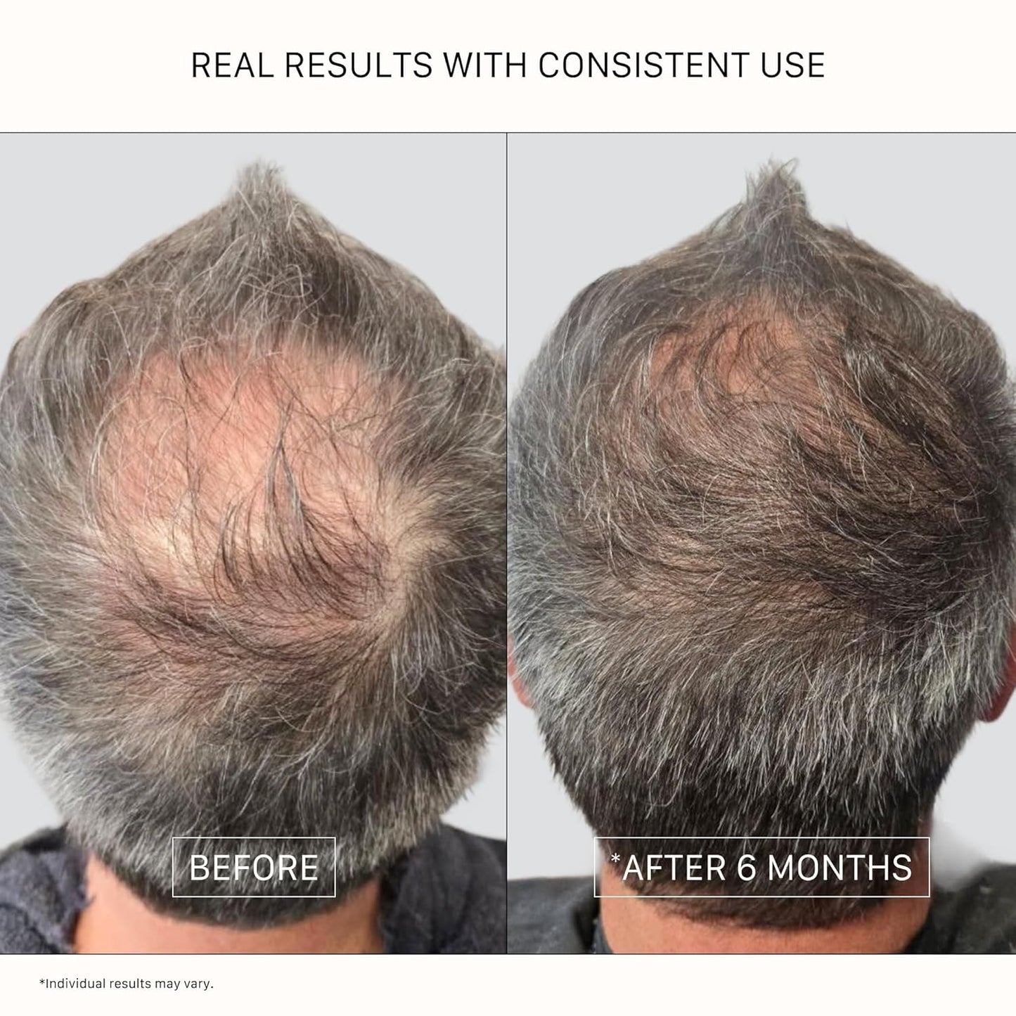 ACTIIV Recover Thickening Conditioner - Strengthens & Hydrates for Thicker, Fuller Hair | Plant-Based, Color-Safe, Unisex