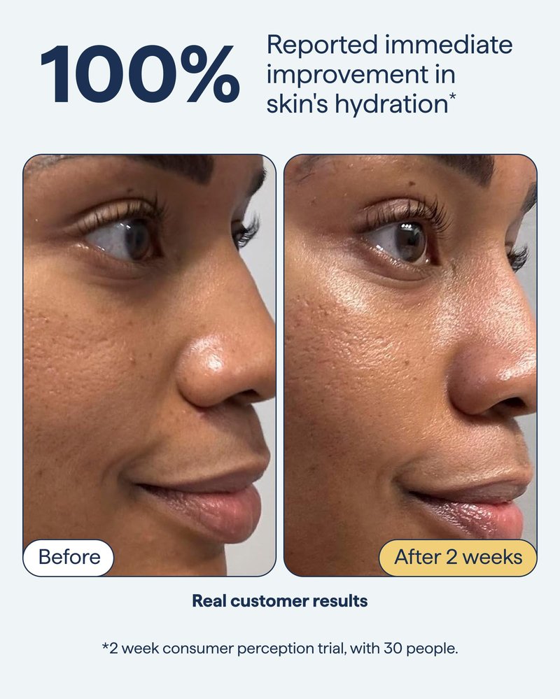 Remedy for Rich Moisture | Barrier Repairing Rich Cream Moisturizer for Normal to Dry Skin | Quadruple Ceramide Complex, Peptides, Squalane, Glycerin | By Dermatologist Dr. Shah, 1.7 fl. oz