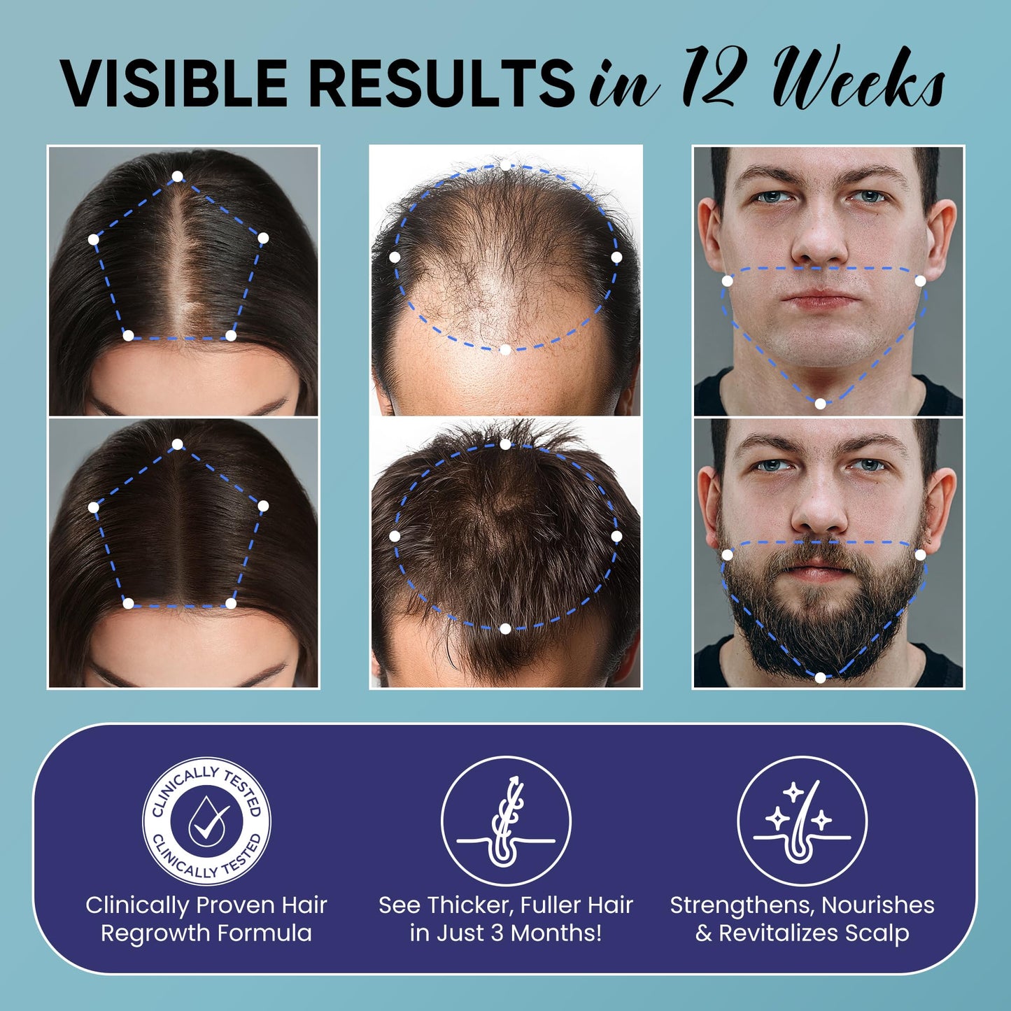 Olivita Hair Growth Spray for Men and Women