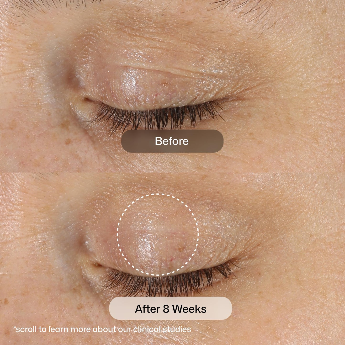 Revision Skincare D·E·J Eye Cream®, Clinically Proven to Reduce Under-Eye Fine Lines and Wrinkles with Peptides and Hyaluronic Acid for a Firmer, Smoother Eye Area, 0.5 fl oz