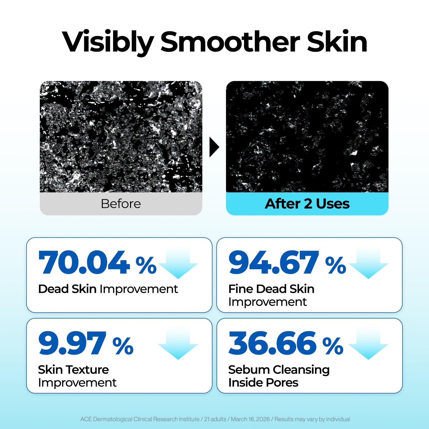 BE THE SKIN BHA+ 30-Second Exfoliator - Gommage Peeling Gel Willow Bark BHA + AHA Melts & Sweeps Dead Skin, Helps Clear Pores & Blackheads, No Harsh Beads for Oily Blemish-Prone Skin | 3.38 fl oz