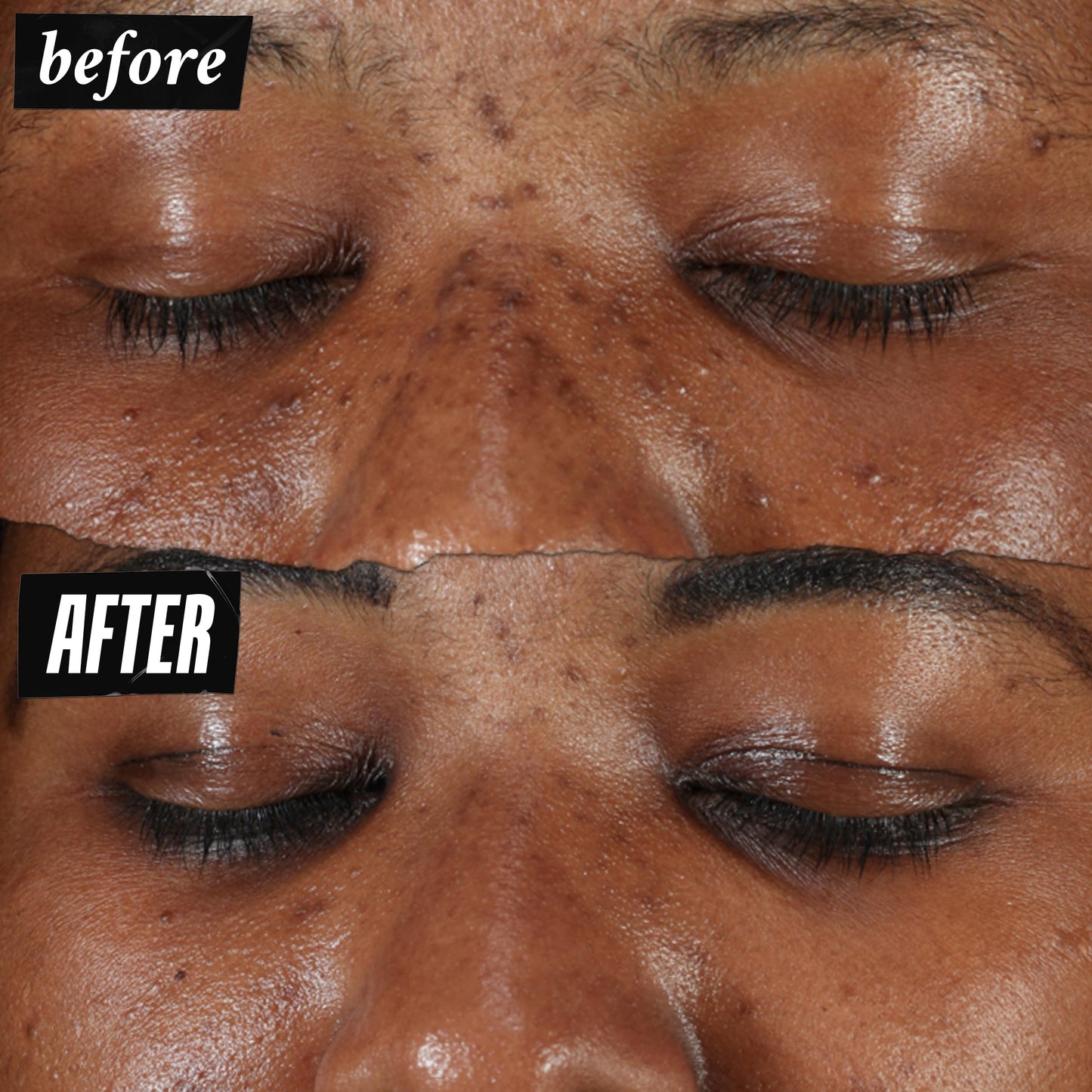 Kiehl's Clearly Corrective Dark Spot Serum, Corrective Skincare Solution Clinically Proven to Even Skin Tone, Plump Skin, Reduce Hyperpigmentation & Boost Radiance, Use as Spot Treatment or Serum